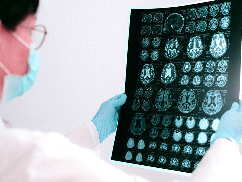Diagnosi demenza alzheimer diagnosi demenza alzheimer